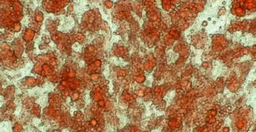 Bioglutide NA-931 uses | Shaanxi BLOOM Tech Co., Ltd Bioglutide NA-931 uses | Shaanxi BLOOM Tech Co., Ltd